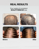 SCALP FORM 001